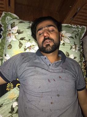 مراسل قناة ان ار تي