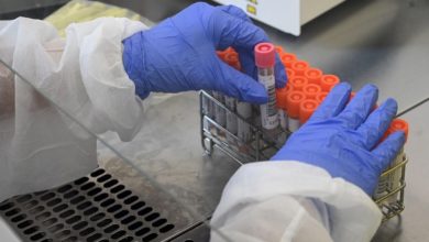 الإمارات : الأبتكار العلمي لمواجهة فيروس كورونا 5 downloadfile 30