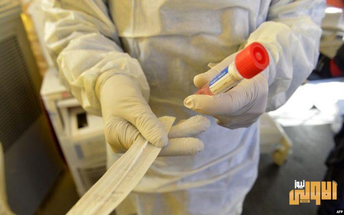 مسحات كورونا 696x435 1