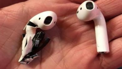 143 142218 apple headphone explodes ear burns injuries 700x400