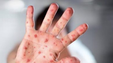 587CC70F 22A3 4267 9984 9A10A1845DB8