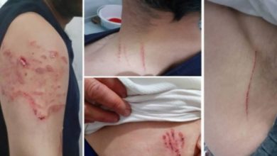 الشرطة التركية تعذب مواطنًا كرديًا بالكلاب الشرسة 2 6BBDB767 CE47 4DEE 8B46 C054E81527F7