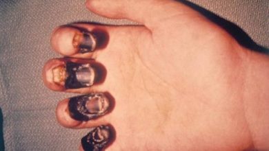 BBAE94E7 DD7F 4584 93B1 F86327B66F03