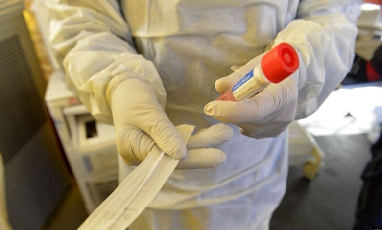 بالانفوغرافيك.. توزيع اصابات كورونا في الكرخ 3 894C1E2A 2BD1 4E54 AB4E 647459FEFEDC