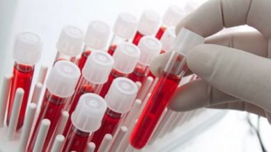 BE55DE20 921E 4420 98A0 FCD7E96BCEEF