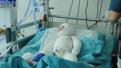 طفلة سورية تفطر القلوب.. نزحت 7 مرات ثم احترقت في مخيم 7 IMG ٢٠٢١٠٢٠٦ ٢٠٣٠١٢ 1