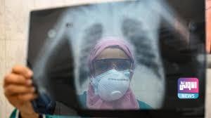 توقعات رسمية بزيادة إصابات كورونا بمصر.. هل إلى موجة ثالثة 6 تنزيل 5 4