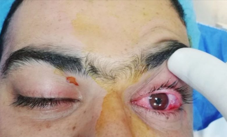 1DDEAD9F E3E8 4A04 BC17 82C7FF4B1BBB