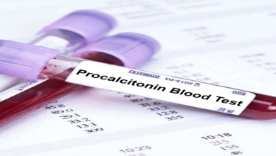 081F3094 B88D 4A30 80CE F00AC7755482