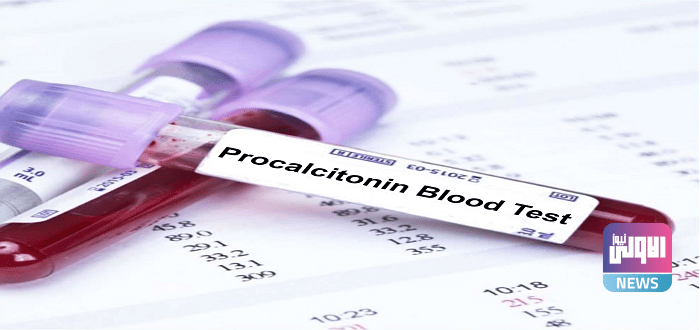 081F3094 B88D 4A30 80CE F00AC7755482