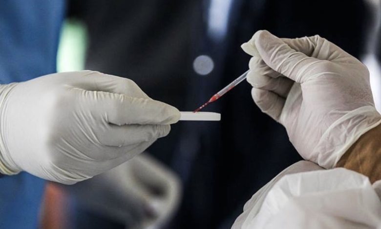 DBBF10ED A95A 4E27 A55B D3C0CFF54CCE