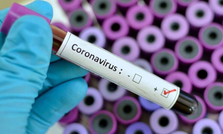 الموقف الوبائي اليومي في اقليم كردستان خلال 24 ساعة 1 IMG 20210420 WA0024