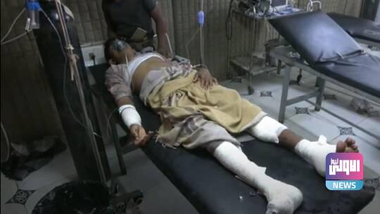 اليمن: تتهم الحوثيين باستهداف سوق شعبية 1 60a0f4944c59b756293fbfbe