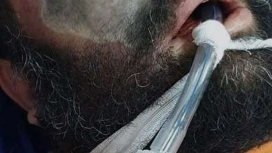 FB1038B2 6E34 49C6 8304 089906AA47D7