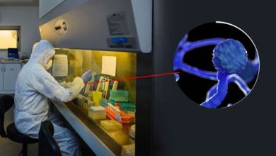 حالة وفاة بالفطر الأسود في النجف 8 585015Image1