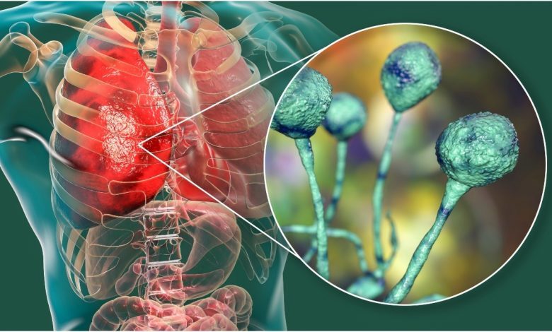 A0830C69 A8C6 49B3 8FA7 5106A2D44B6E