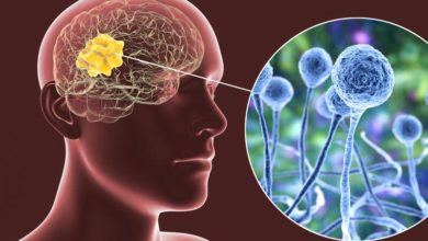 CABF69B2 7D6F 4B4E A61D E2C6D0C259DD