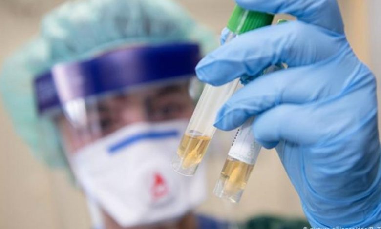 الولايات المتحدة: بؤرةجديدة كبيرة لانتشار فيروس كورونا 1 E6882516 5F55 4AF6 8DFC 57E732FFC545