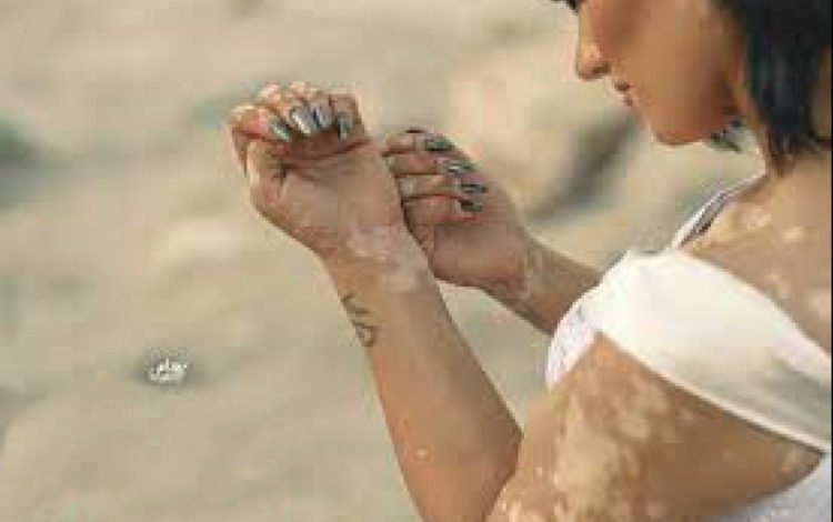 10130DDE 2983 44B9 899A 07AAEC67D64A