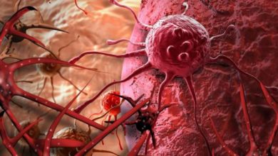 9605E791 359A 448C 9832 84CBBA9650DC