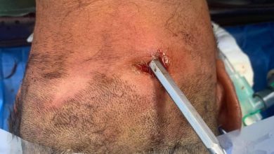 D9BBF1E4 8F24 40F6 B85B 2382D4FB1E43