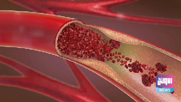 61fb7f0a42360466a116432e