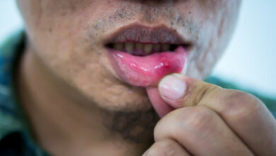 62066a6742360479a3173e34