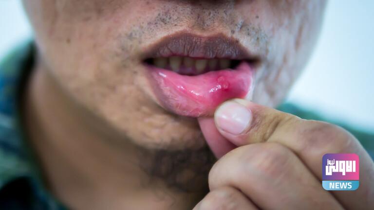 62066a6742360479a3173e34