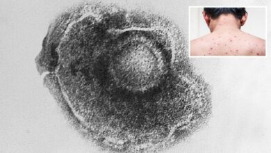 شخص واحد ينقل العدوى لـ13 آخرين تحذيرات من مرض خطير جدا ينتشر أسرع من فيروس كورونا 2 6215e6884236047b6707591f