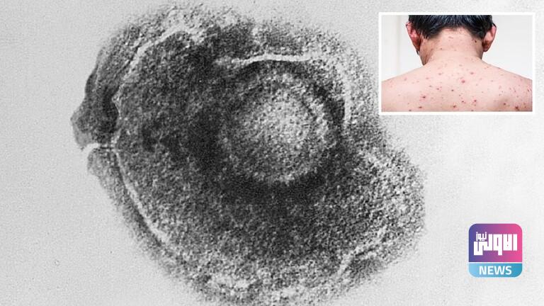 6215e6884236047b6707591f