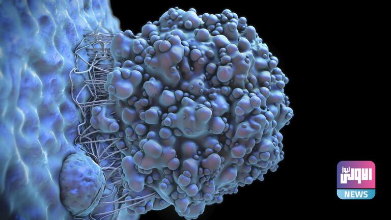 622370604c59b70ab742e308