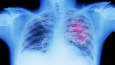 622ef85b42360402af5fe91a