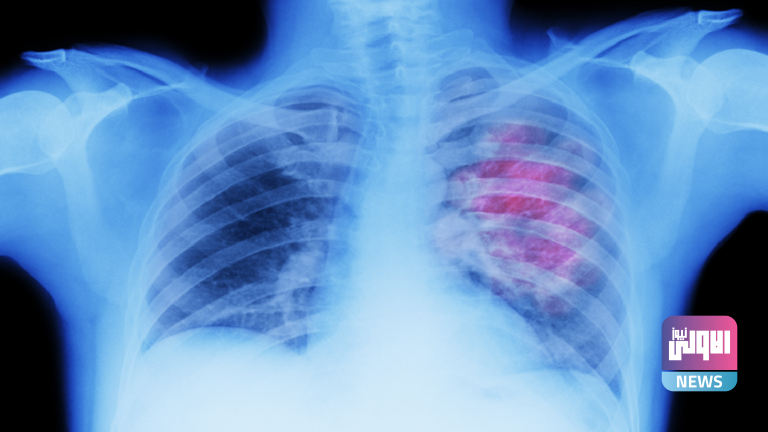 622ef85b42360402af5fe91a