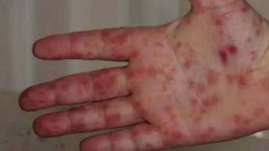 30C75042 8941 49A2 8905 5C1EF20AFC5B