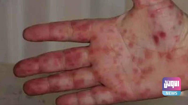 30C75042 8941 49A2 8905 5C1EF20AFC5B