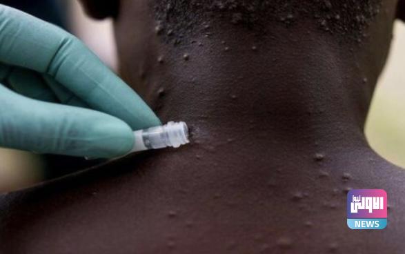 717179D2 B73A 4BAD 81FB 099F545AADB3