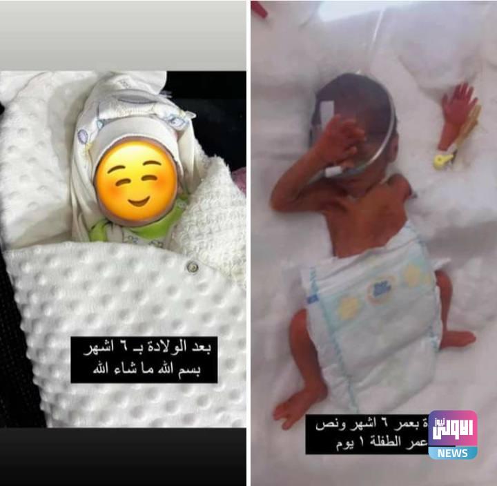 انقاذ حياة و علاج طفلة حديثة الولادة (خدج) بوزن اكثر من نصف كيلو غرام في مستشفى ابي غريب العام 1 955D8067 5755 4C76 9046 018C7C4B8FC0