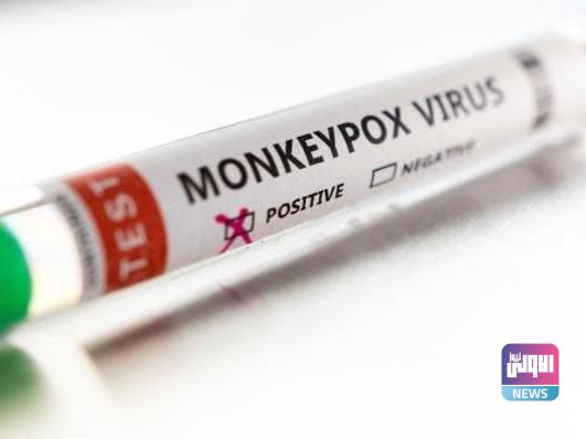 الصحة العالمية: يمكن إيقاف انتقال جدري القرود خارج دول تفشيه 1 upload 1653318241 12709665