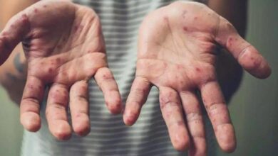 upload 1653406512 2003497055