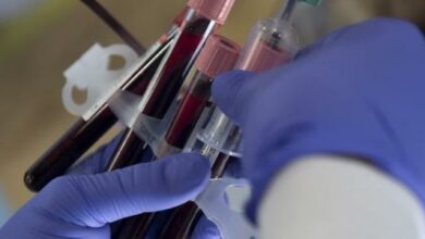 تحليل دم كامل