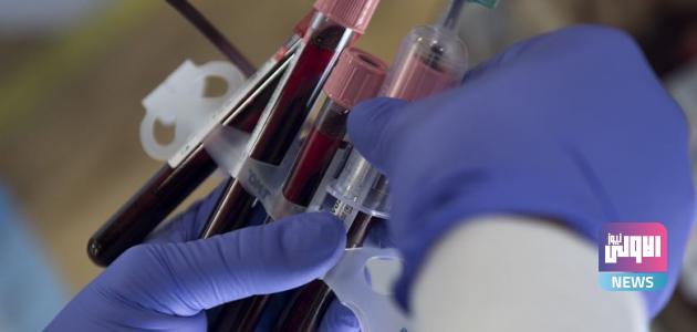 كركوك تسجل أول حالة وفاة بالحمى النزفية 1 تحليل دم كامل