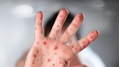 5BC5A760 D728 47C0 A956 CF8F953F9303