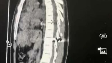 694A1642 CB9E 4F3E AEDB 2E7D6ECD4374