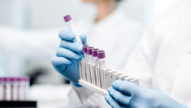 الصحة تسجل 1905 إصابات جديدة بكورونا 2 74f49b90ab5bf4d829889ad51434c9d1