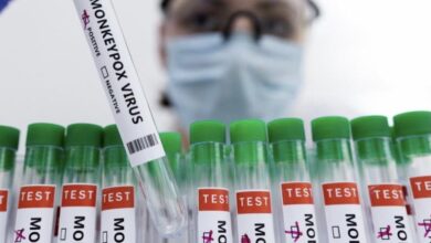 تسجيل 4 أصابات جديدة بجدري القردة في الأمارات 5 A776E30A 339A 401C AA60 A1D9CD13FC73