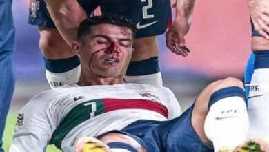 163 212756 cristiano ronaldo black eye 700x400