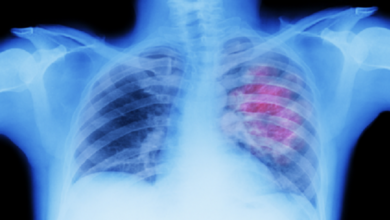 63452bdd4c59b7048e1d5f3a