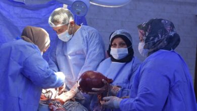 22A893DB 1CA7 4393 8106 E30182DCE863