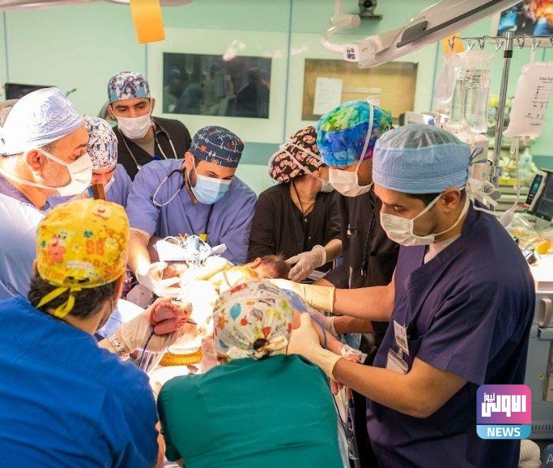 السعودية تعلن بدء المرحلة الرابعة لعملية فصل توأمين عراقيين متلاصقين 1 IMG 20230112 153745 848