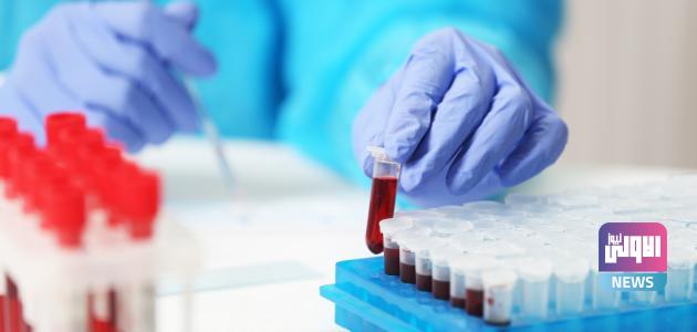 الصحة تعلن تسجيل 30 حالة وفاة وإصابة بالحمى النزفية 1 رموز التحاليل الطبية ومعدلاتها الطبيعية